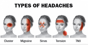 Types of Headaches & Migraines