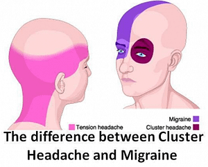Headache & Migraine Pain Location