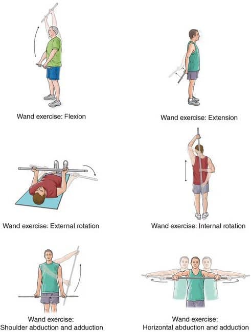 Exercise Rehabilitation for AC Joint Injuries